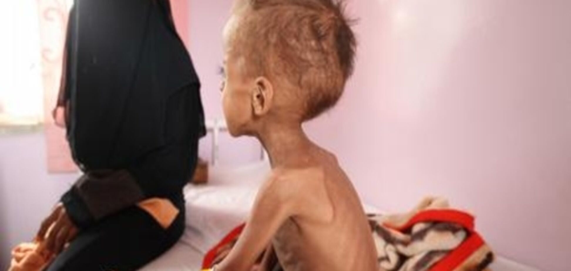 ЮНІСЕФ: Життя майже півмільйона дітей в Ємені під загрозою