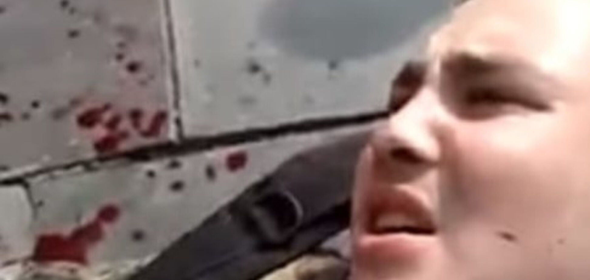 Виталий Регор после ранения