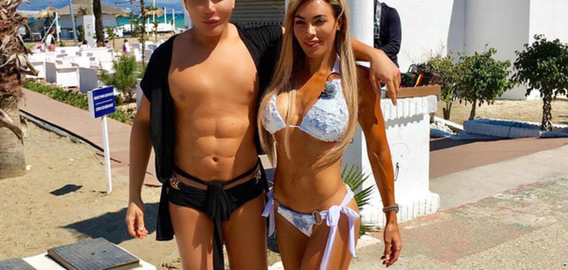 'Басков на максималках': результаты 'тренировок' модели из Бразилии шокировали соцсети