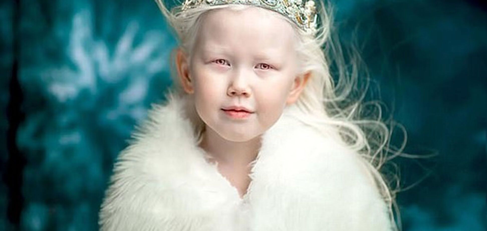 'Белоснежка': 8-летняя девочка-альбинос покорила своей красотой