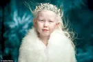девочка альбинос