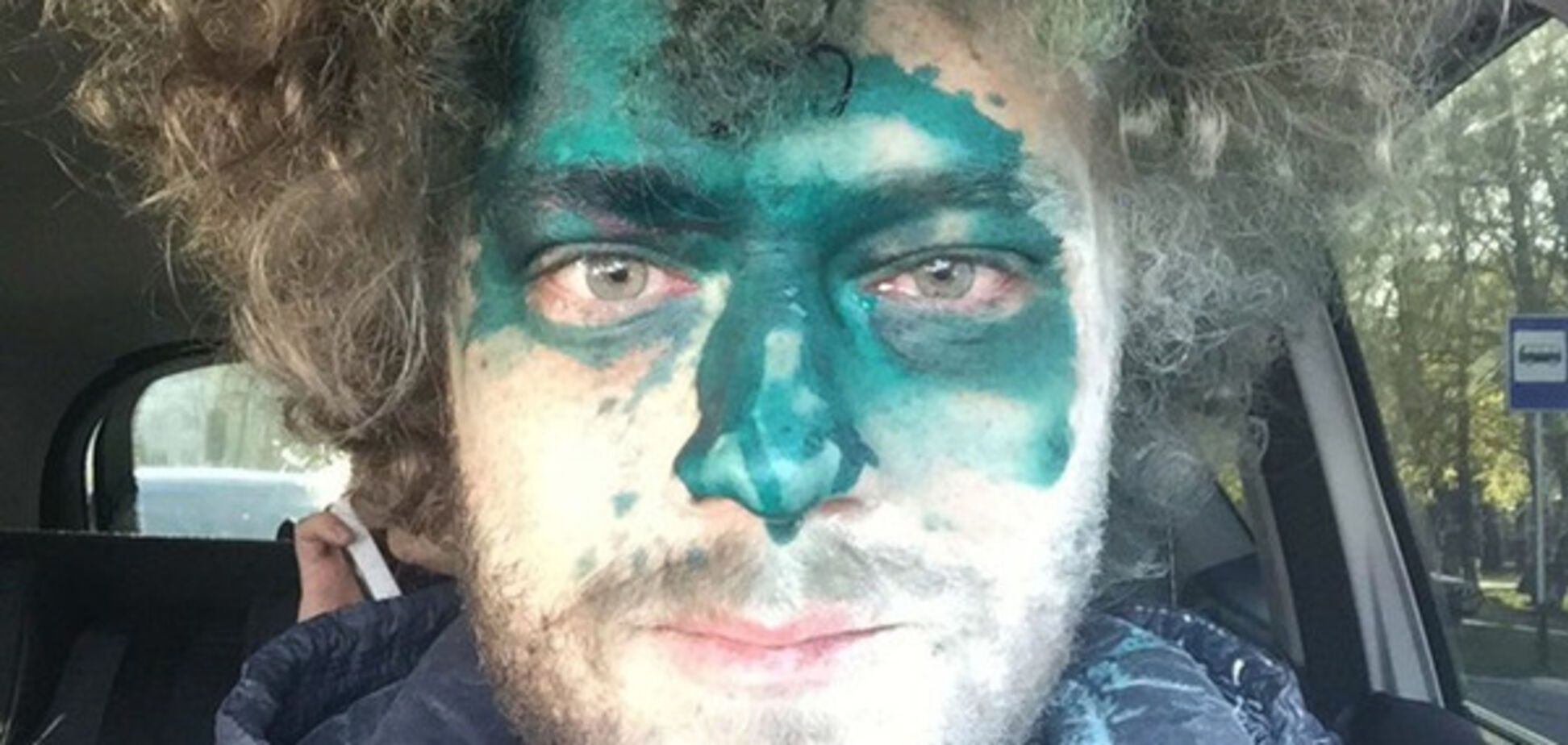 Варламова облили зеленкой