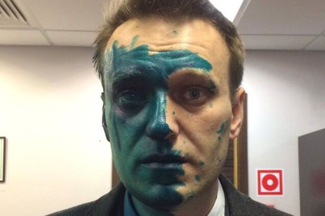 Алексей навальный в зеленке