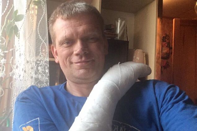 Ігор Швайка після ДТП