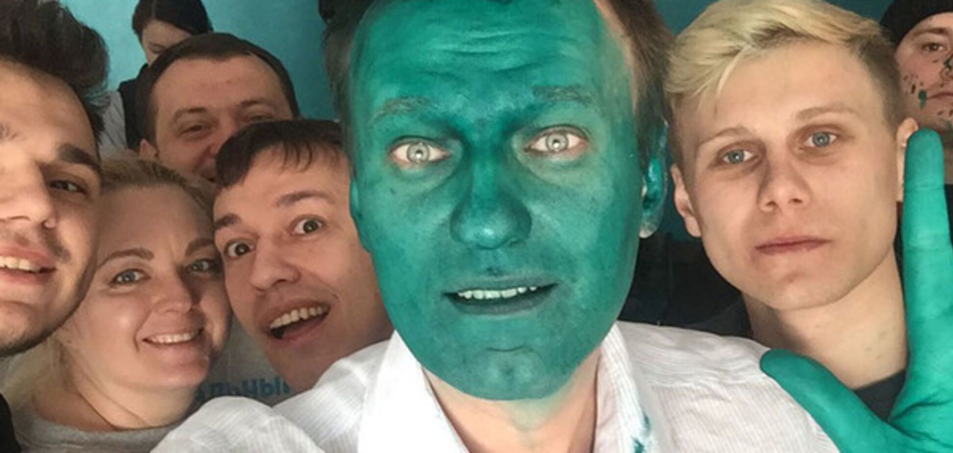 навальный в зеленке