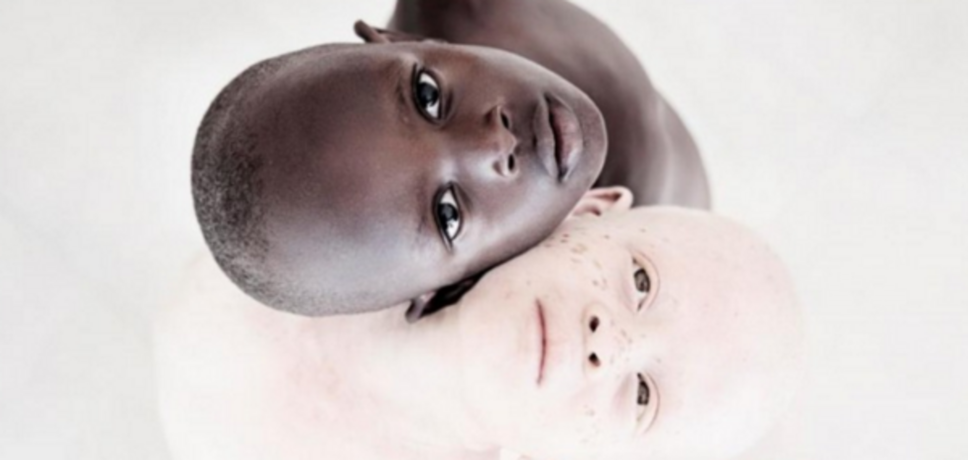 альбиносы танзании