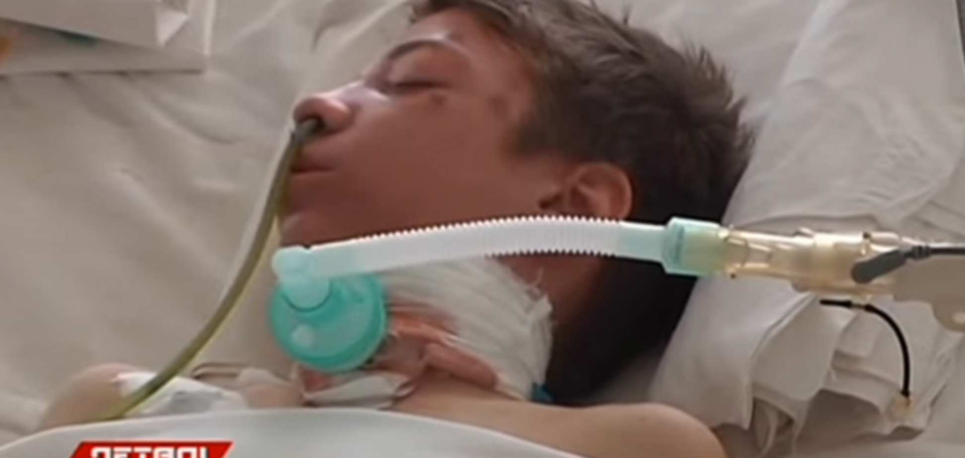 Перерезали горло: появилось видео с раненым мальчиком под Днепром