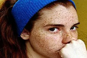 Средства и способы избавления от пигментных пятен на лице