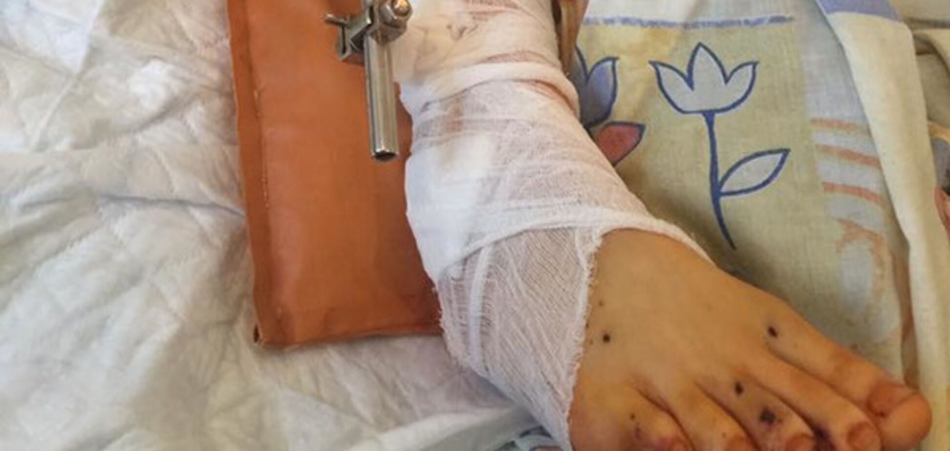 Допомога пораненим в АТО військовим