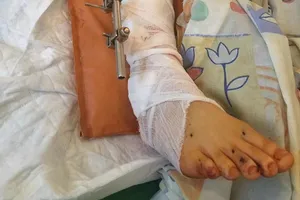 Помощь раненым в АТО военным