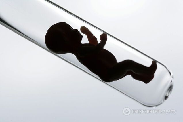 Вчені назвали відмінності у розвитку дітей, народжених за допомогою ЕКЗ