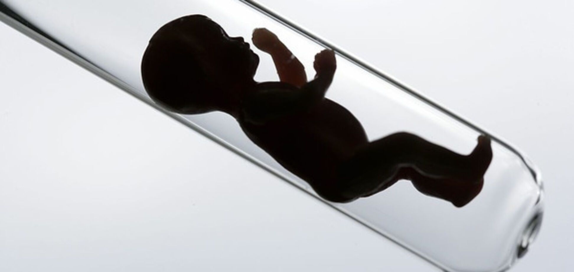 Ученые назвали различия в развитии детей, рожденных с помощью ЭКО