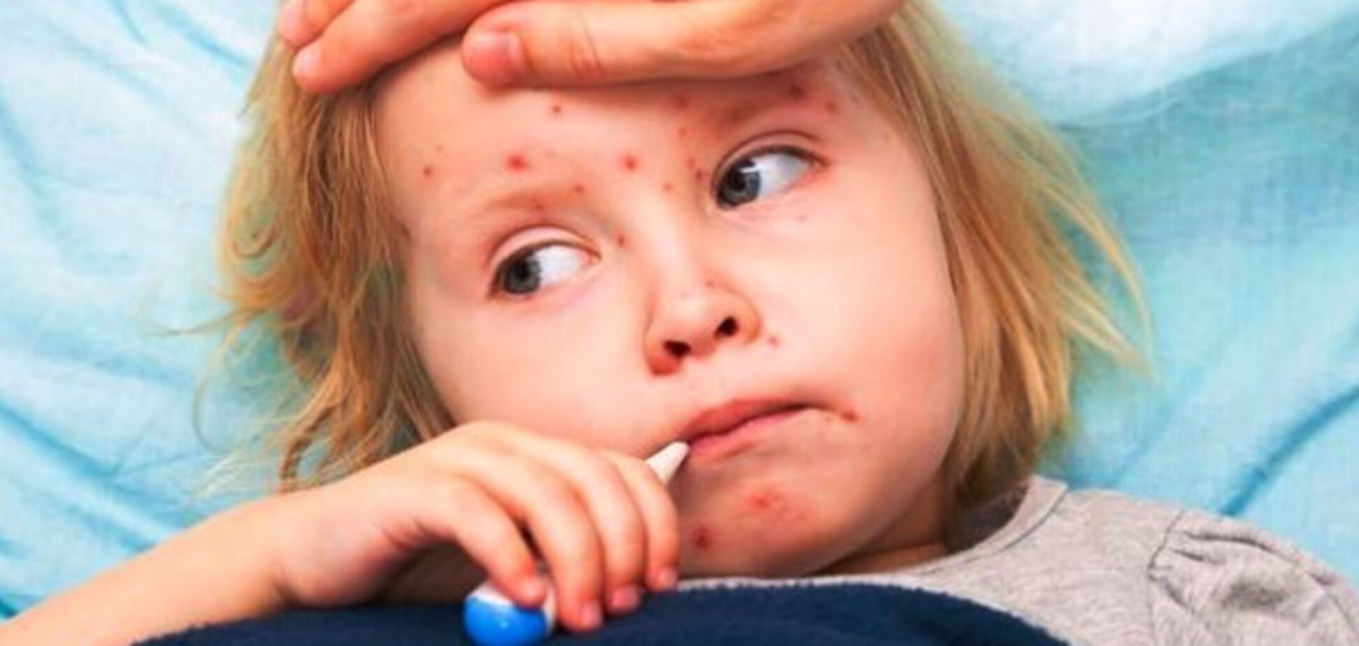 О вакцинах для сомневающихся: шесть причин, почему нужно прививать от кори