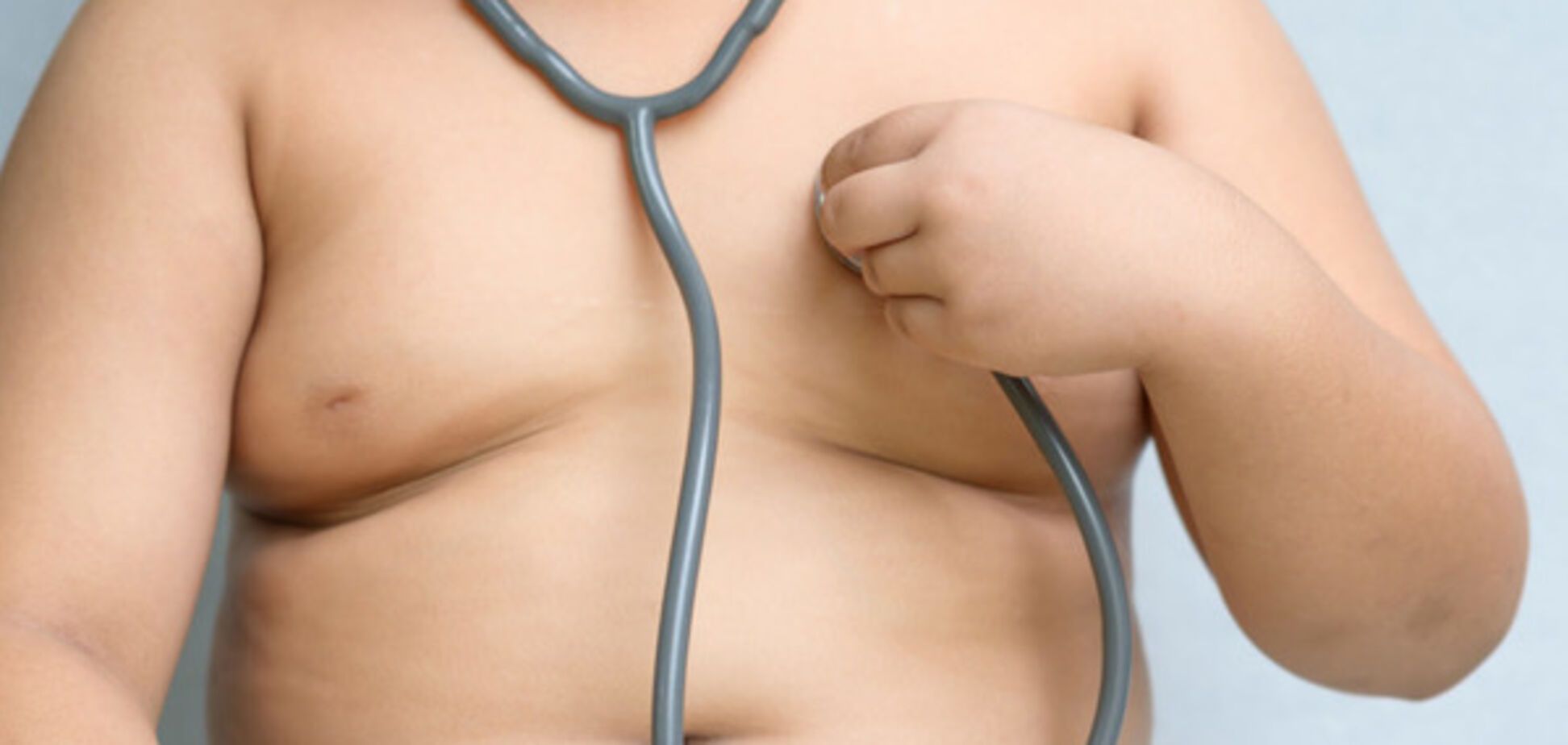 Вчені пояснили, як ожиріння в дитинстві впливає на здоров'я в майбутньому