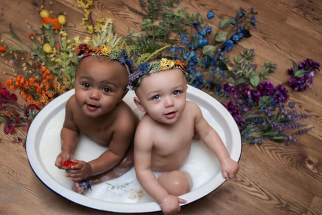 Они не просто сестры, они близнецы: снимок девочек с разным цветом кожи покорил сеть