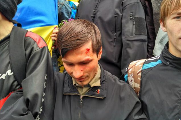 В Киеве парню крепко досталось за бандеровский флаг: опубликованы фото