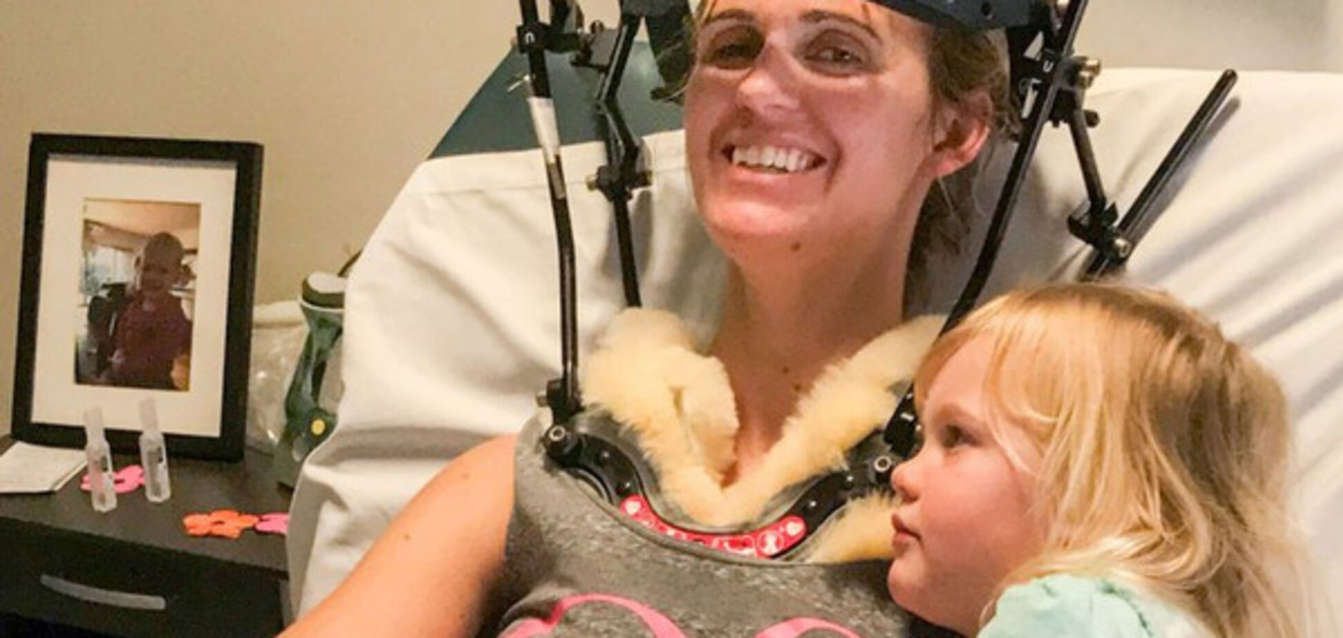 Нервы ни к черту: молодая женщина дважды сломала шею из-за чиха и смеха