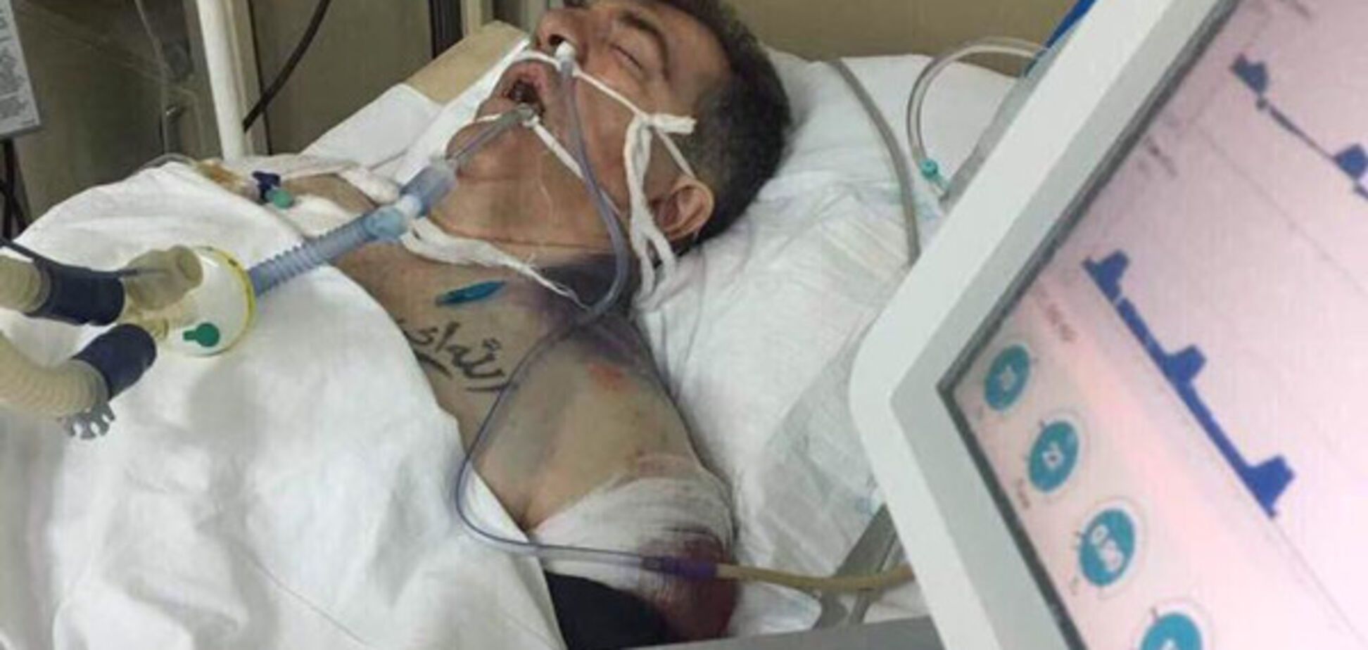 кілер Осмаєва