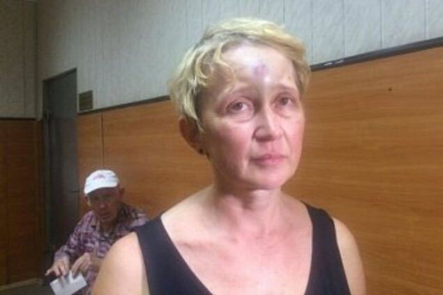 Світлана підпаливши