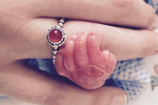 Дівчина зробила несамовиті фото з ненародженим малюком, загиблим у ДТП
