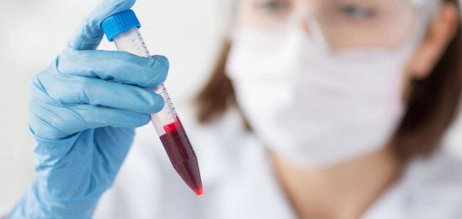 Анализ крови на аллергены: как делают и для чего нужен?