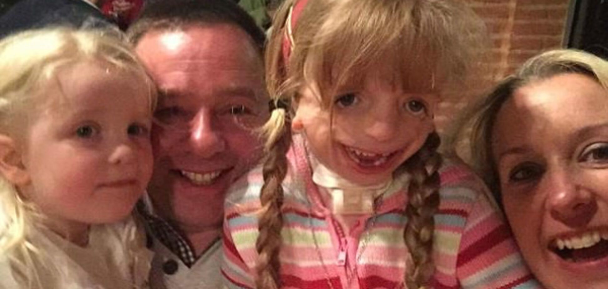 Девочка пережила 29 операций на лице, но остается самой счастливой: поразительная история