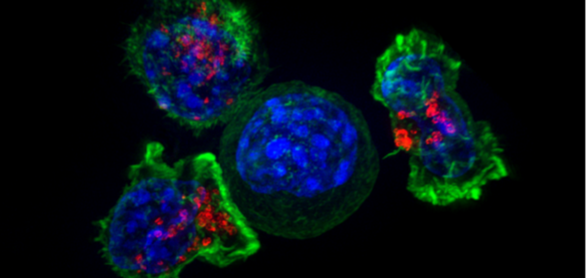 Вчені знайшли ключовий механізм, здатний 'атакувати' ракові клітини