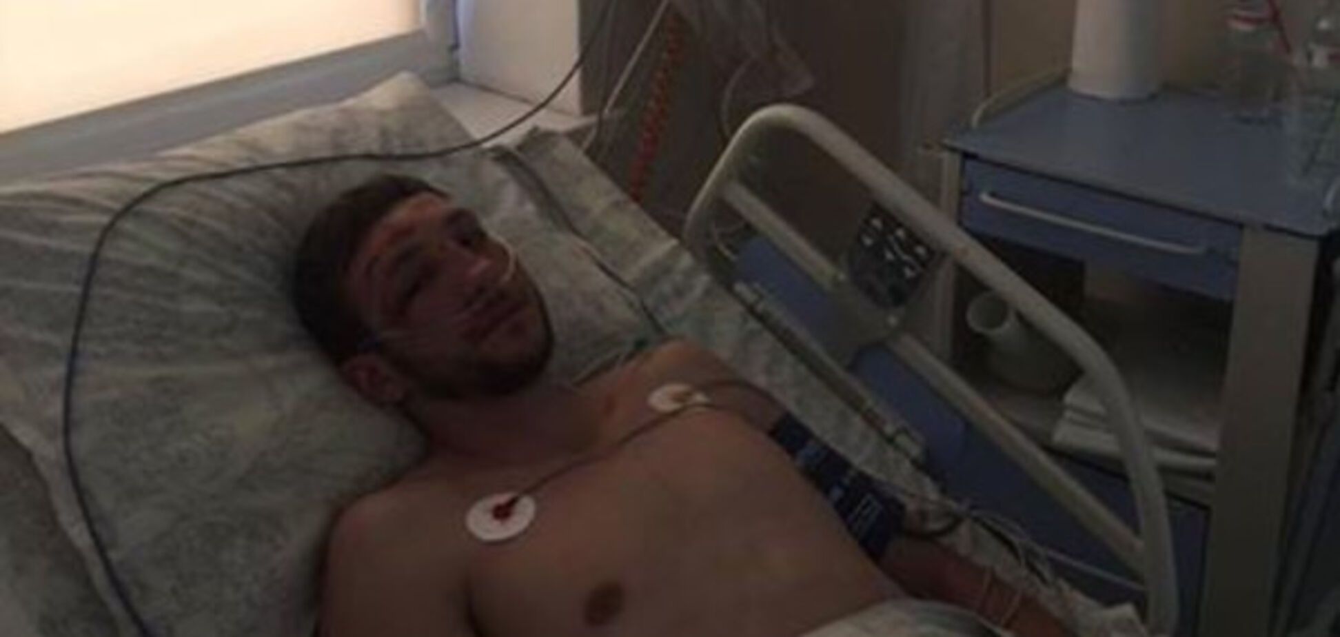 Избитый Алексей Марченко