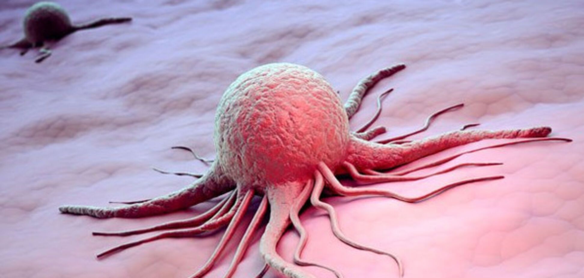 Вчені розгадали, як лікувати один із найагресивніших видів раку