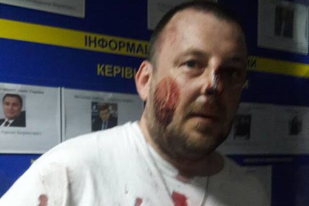 Бійка в Києві