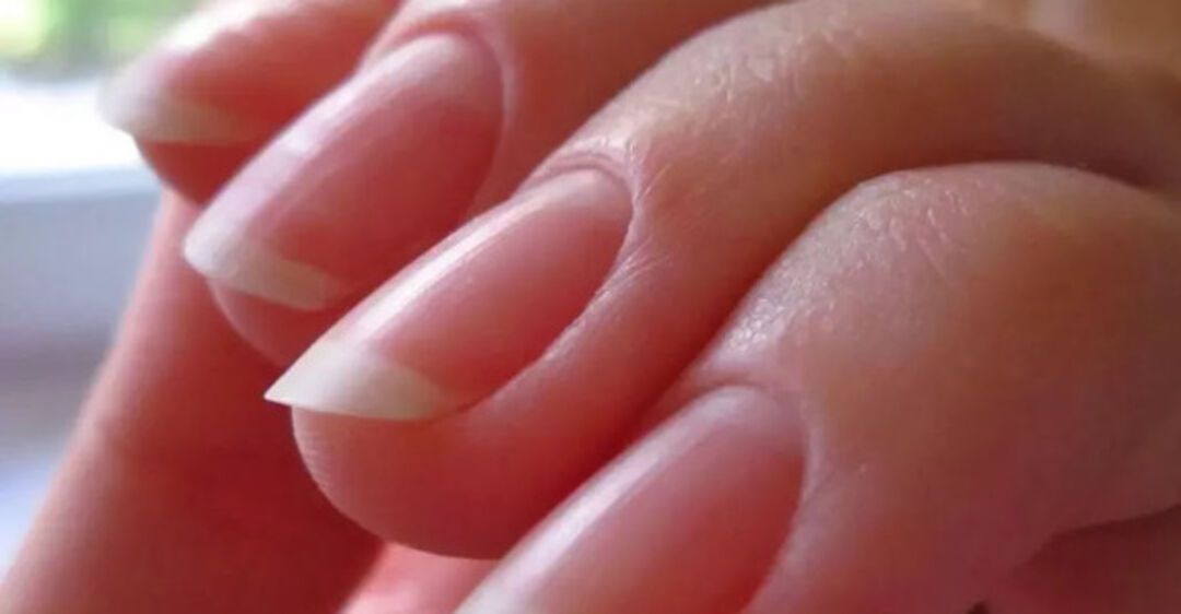 Диабет, рак и СПИД: 10 секретов, о которых могут рассказать ногти .