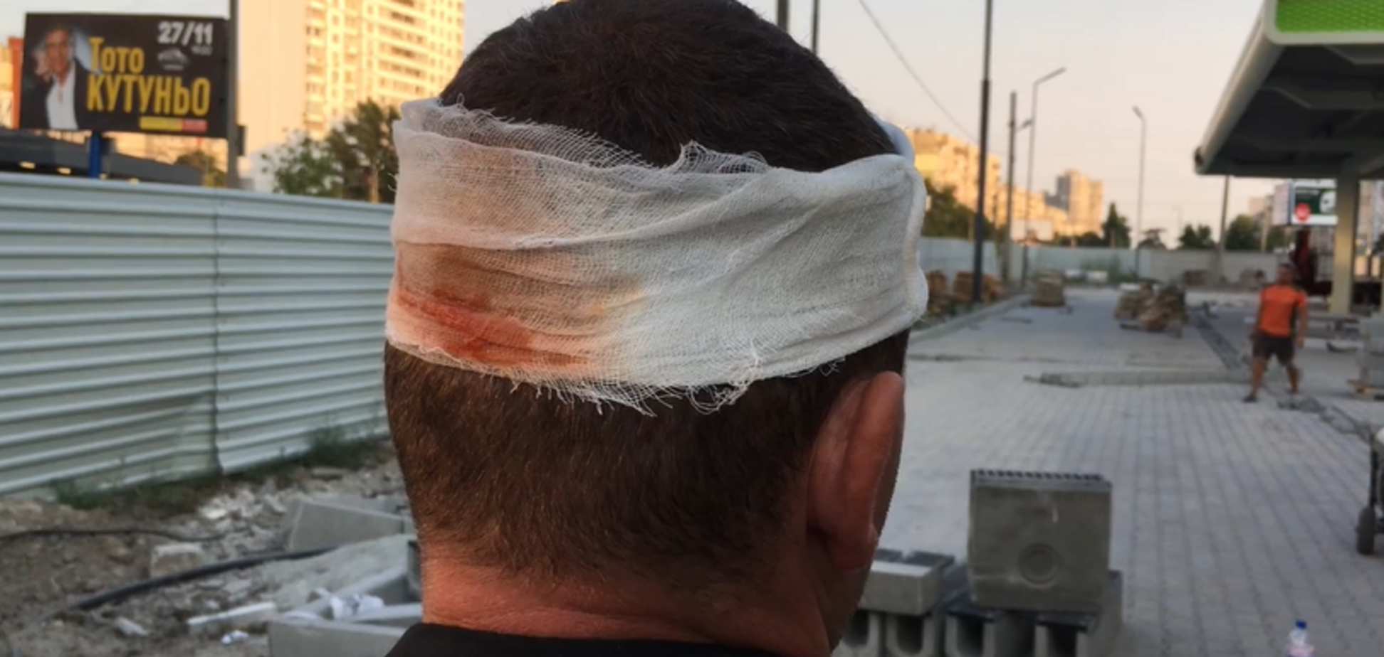 На Ревуцкого титушки, которые перекрывали дорогу, проломили голову охраннику заправки