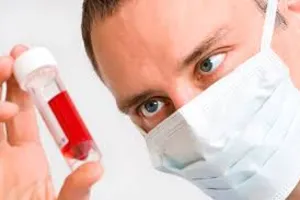 У Києві підтвердили першу смерть від небезпечного інфекційного захворювання