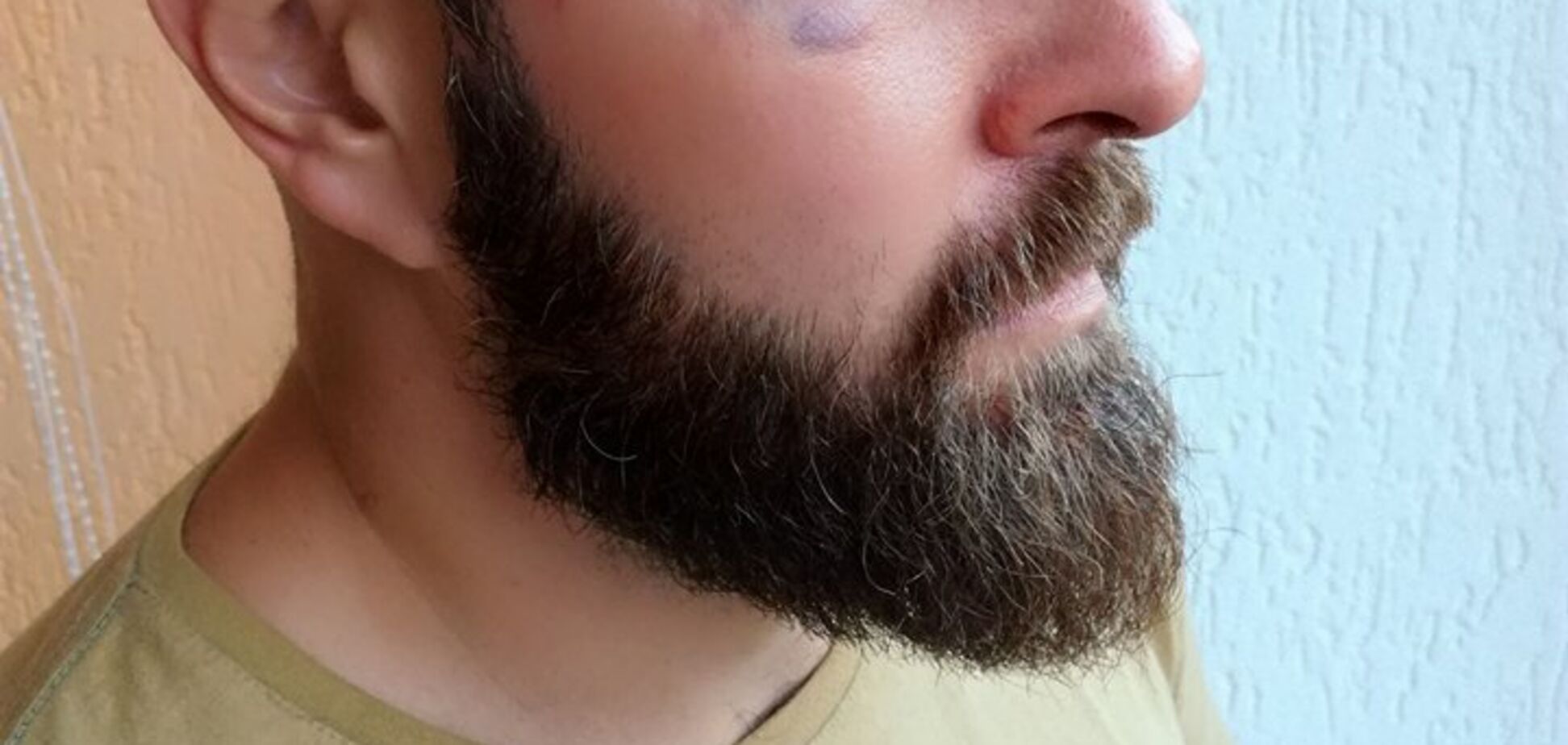 За самозахист активісту загрожує позбавлення волі на 10 років