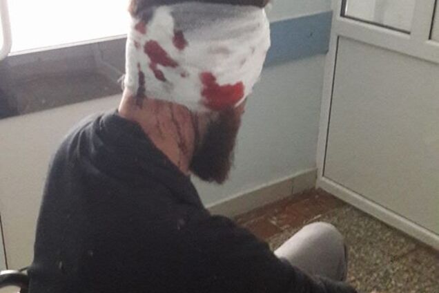 'Напали сзади и добивали ногами': в Харькове жестоко избили депутата