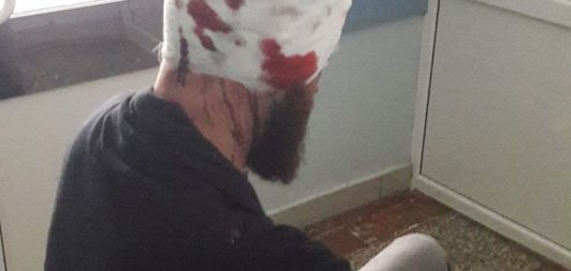 'Напали ззаду і добивали ногами': у Харкові жорстоко побили депутата