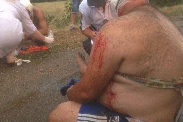 Стрілянина під Миколаєвом: в хід пішли 'травмати' і ножі