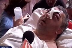 Сломали челюсть по воле Саакашвили: стало известно о жутком инциденте в Грузии