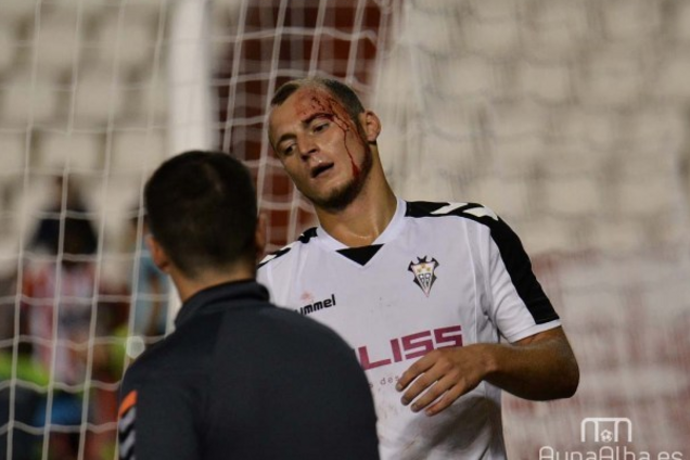 Футболістові збірної України розбили голову в дебютному матчі за новий клуб: з'явилися фото інциденту