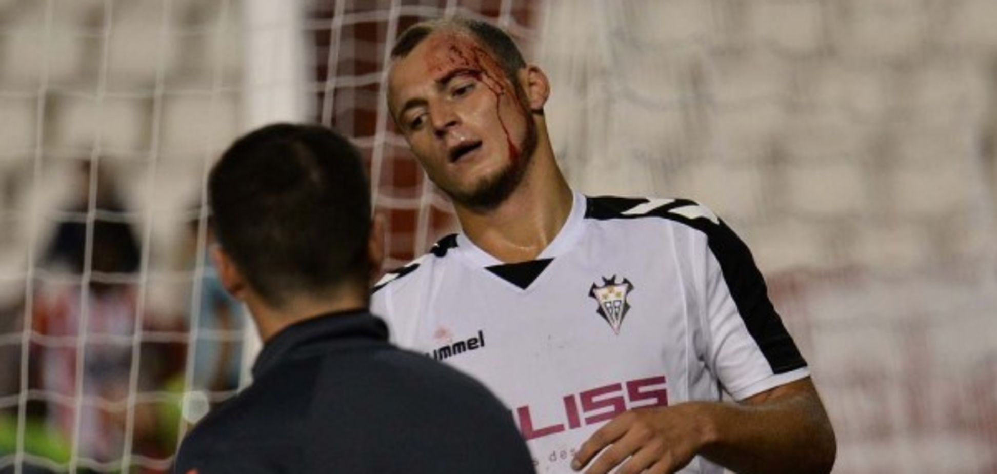 Футболисту сборной Украины разбили голову в дебютном матче за новый клуб: появились фото инцидента