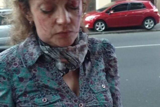 Голова разбита до крови: в Одессе напали на проукраинскую активистку