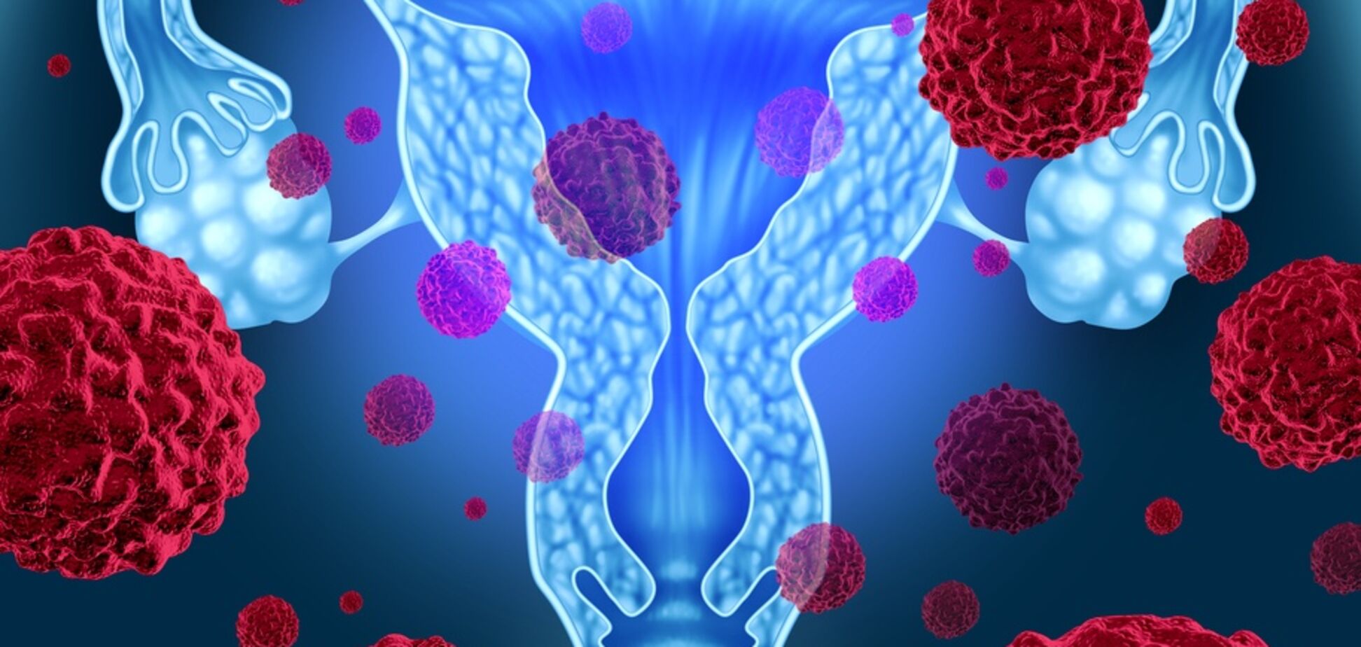 Врачи указали на важные симптомы 'женского' рака