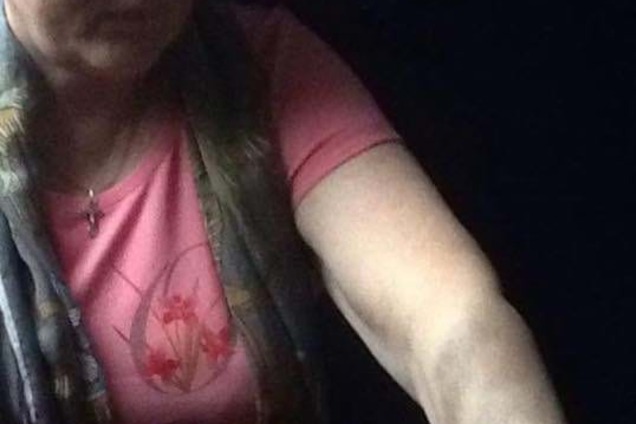 Не побили, а впала: у СІЗО пояснили травми одіозної сепаратистки Штепи