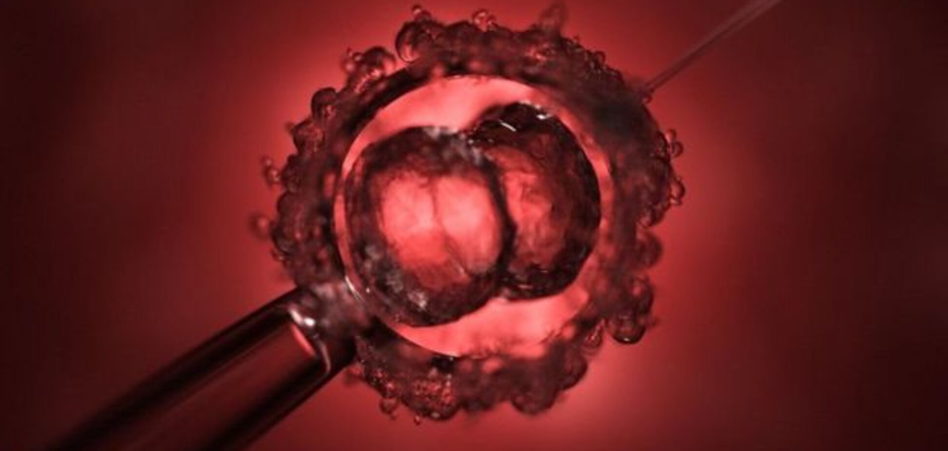 Ученые вылечили смертельное заболевание на стадии эмбриона