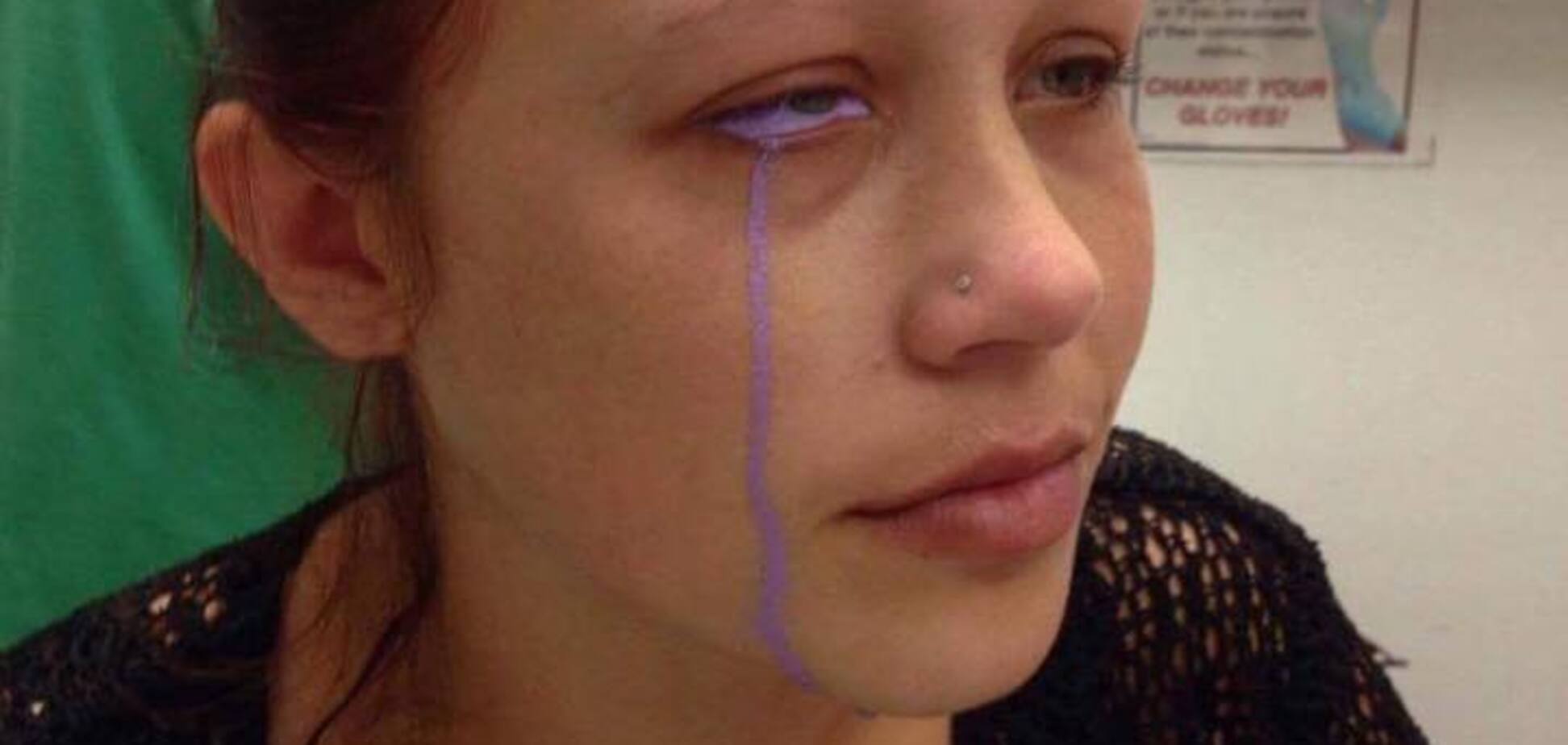 Текли фиолетовые слезы: неудачная татуировка изуродовала глаз модели 