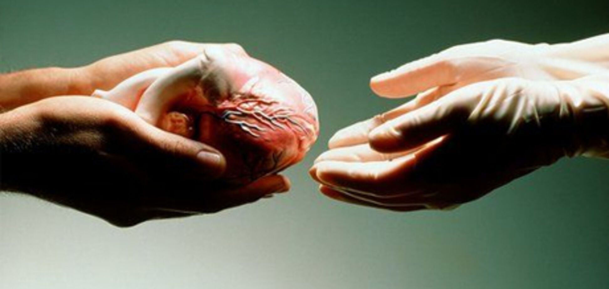 МОЗ підтримав законопроект про трансплантацію органів