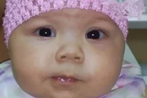 Настя, хворіла онкозахворюванням, померла