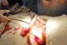 деревянный кол в шею