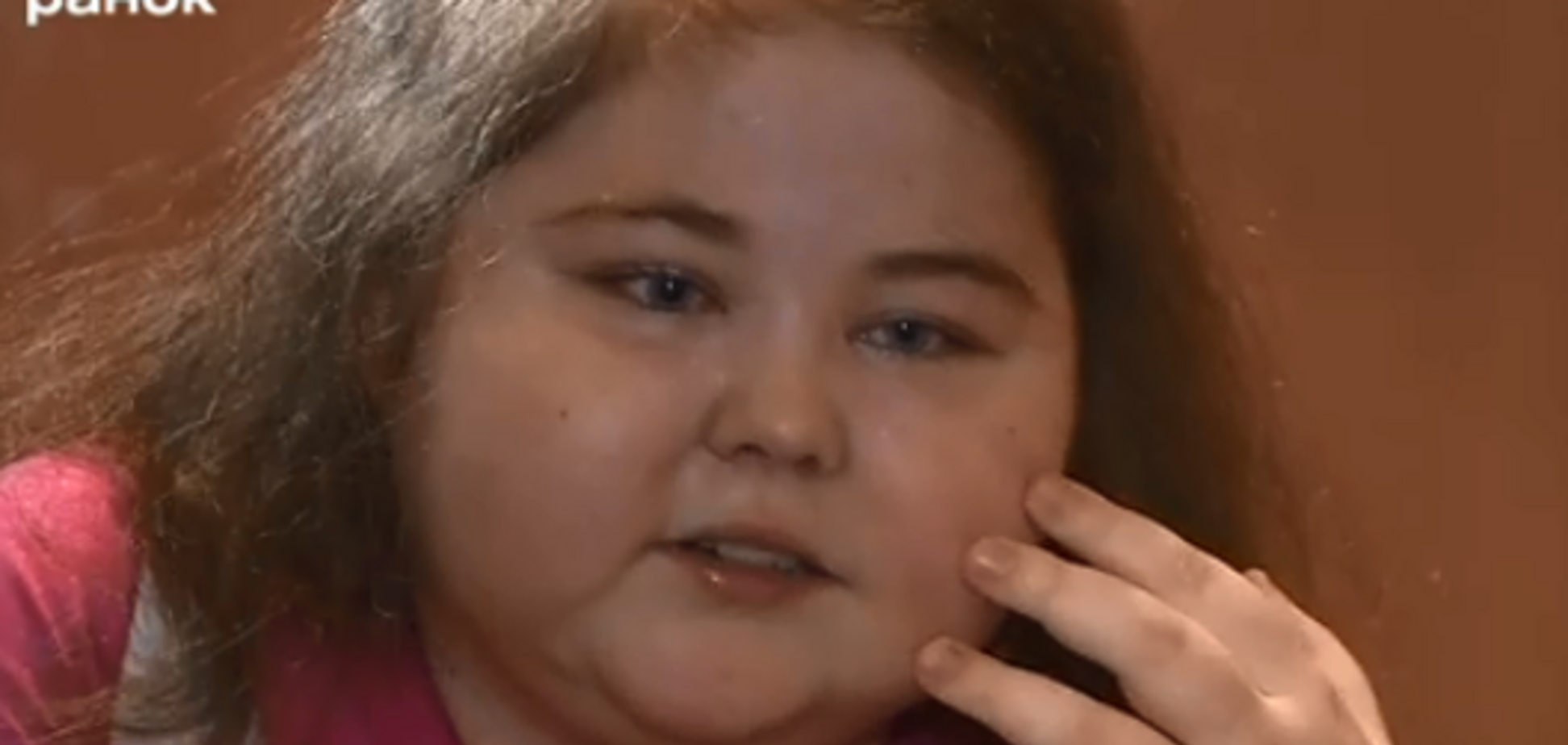 Набрала 20 кг и почти не может ходить: 14-летнюю украинку сразила редчайшая болезнь