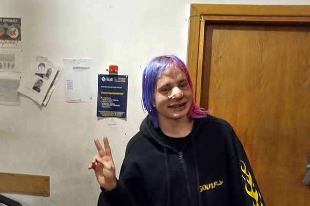 Просит денег на лечение: всплыли подробности жестокого избиения британца в Киеве